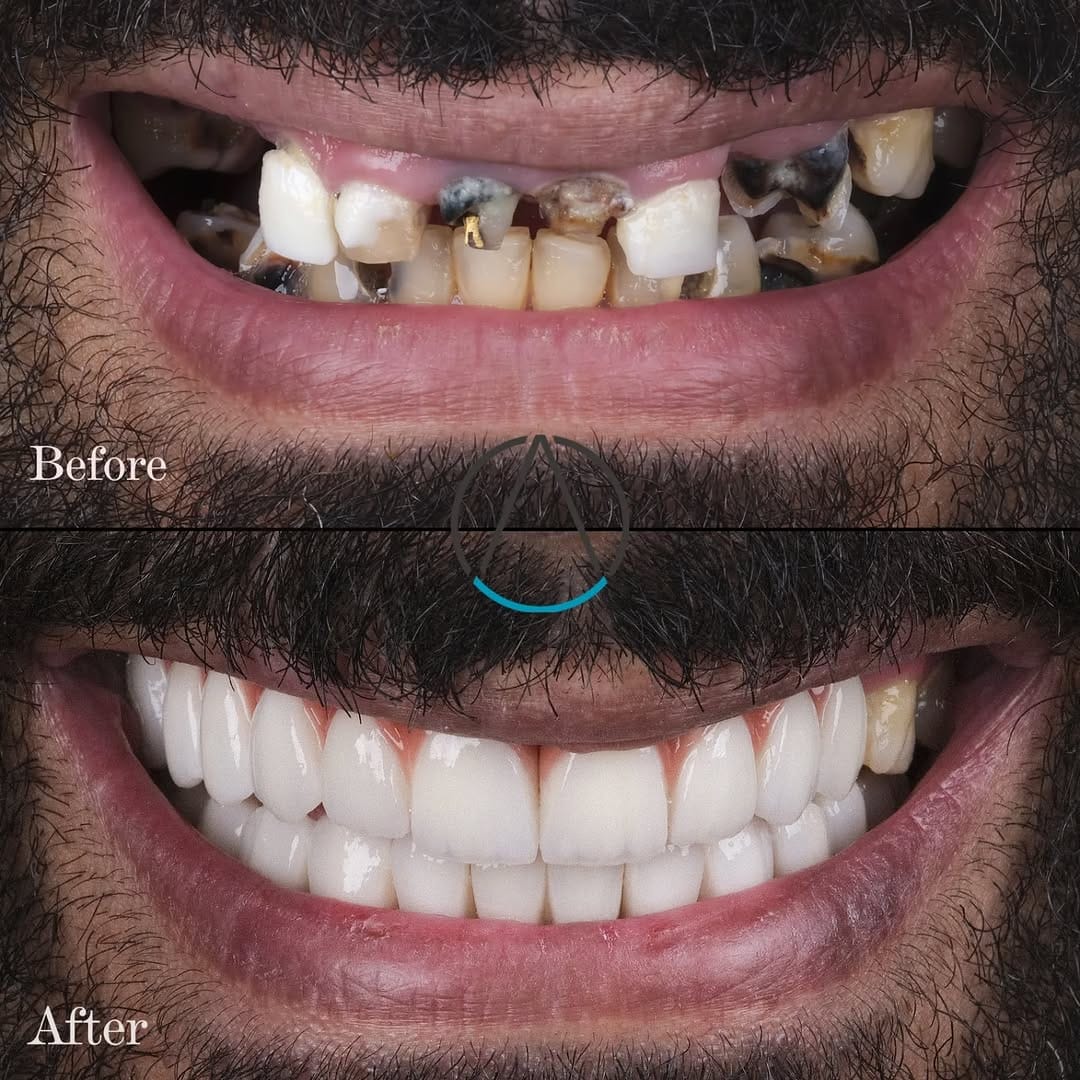 Post 5 by Dr. Omid Amiri Nasab on Instagram (carousel)