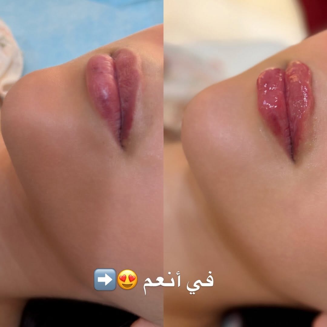 Post 2 by Roula Al Shehadat on Instagram (carousel)