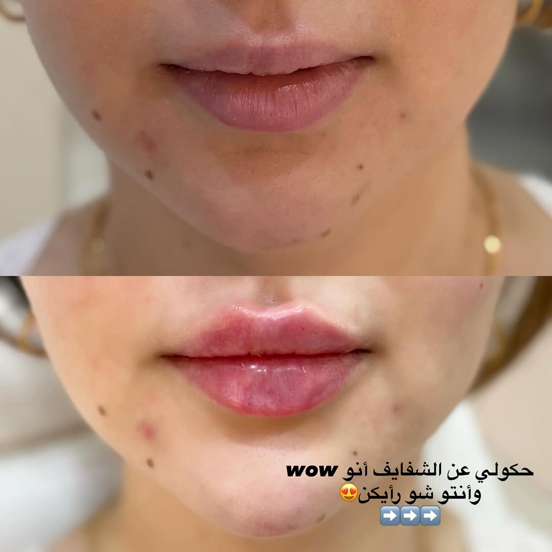 Post 8 by Roula Al Shehadat on Instagram (carousel)