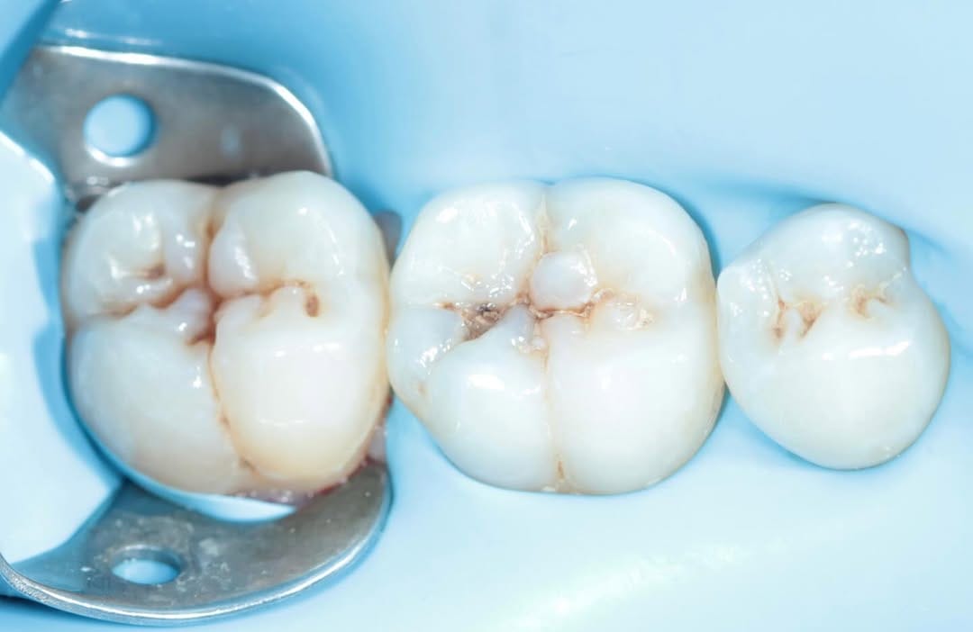 Post 5 by Dr.Amna Abdulhameed DDS 🇧🇭🕊️ on Instagram (carousel)