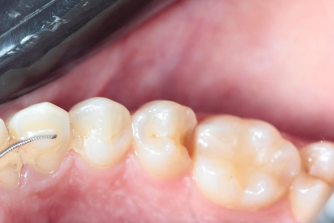Post 3 by Dr.Amna Abdulhameed DDS 🇧🇭🕊️ on Instagram (carousel)
