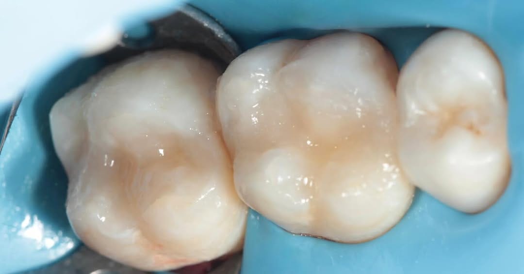 Post 2 by Dr.Amna Abdulhameed DDS 🇧🇭🕊️ on Instagram (carousel)