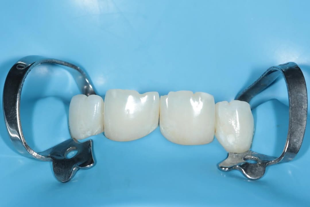 Post 4 by Dr.Amna Abdulhameed DDS 🇧🇭🕊️ on Instagram (carousel)