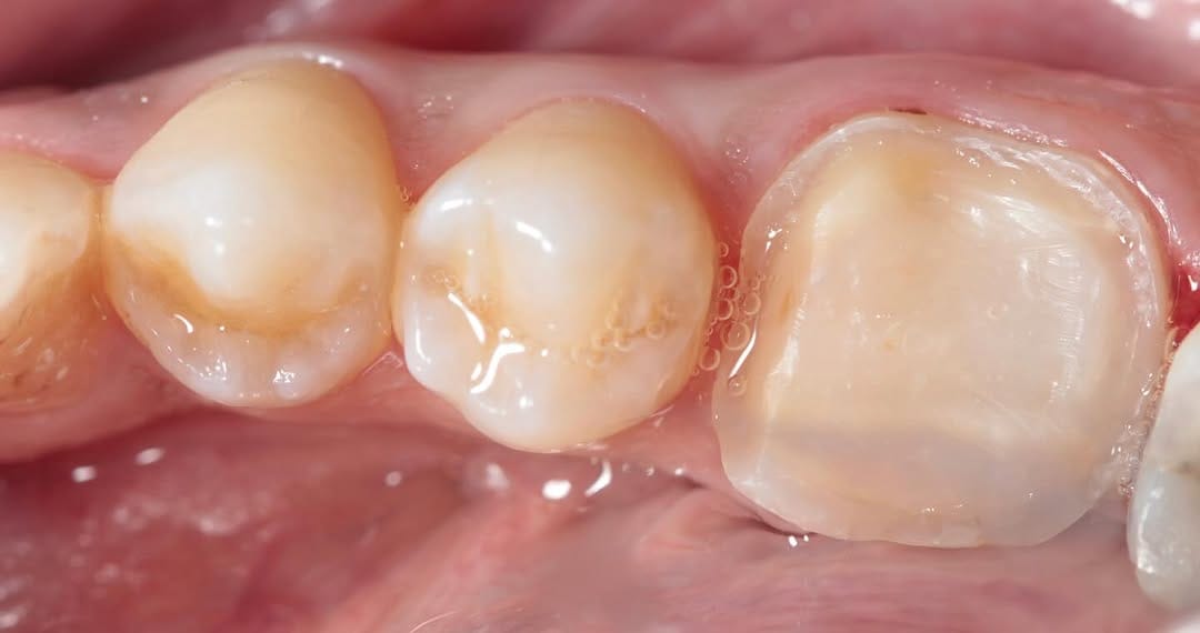 Post 6 by Dr.Amna Abdulhameed DDS 🇧🇭🕊️ on Instagram (carousel)