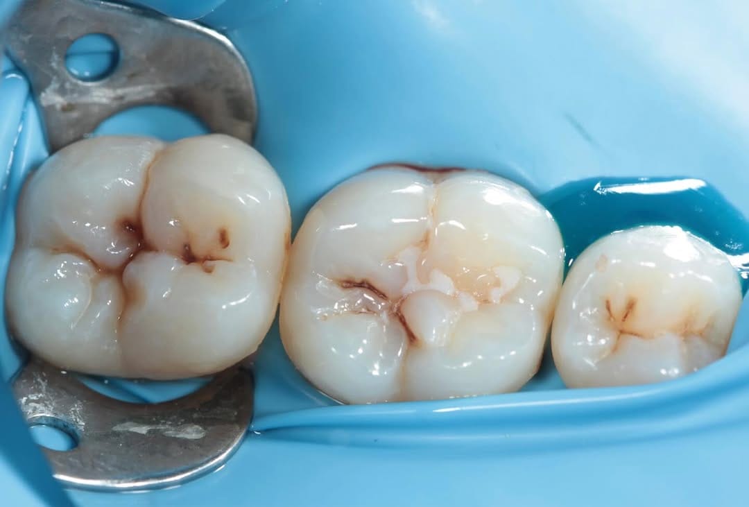 Post 7 by Dr.Amna Abdulhameed DDS 🇧🇭🕊️ on Instagram (carousel)