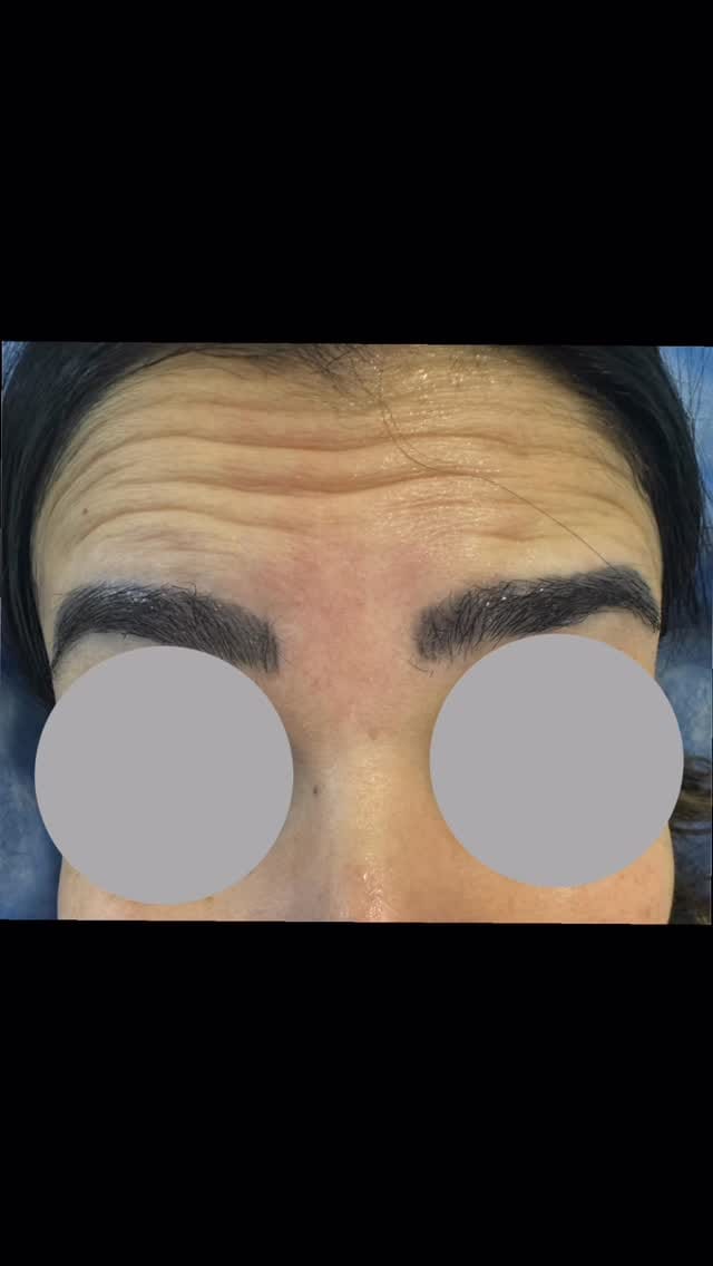 Post 9 by Dr. samartuqan | سمر طوقان on Instagram (video)