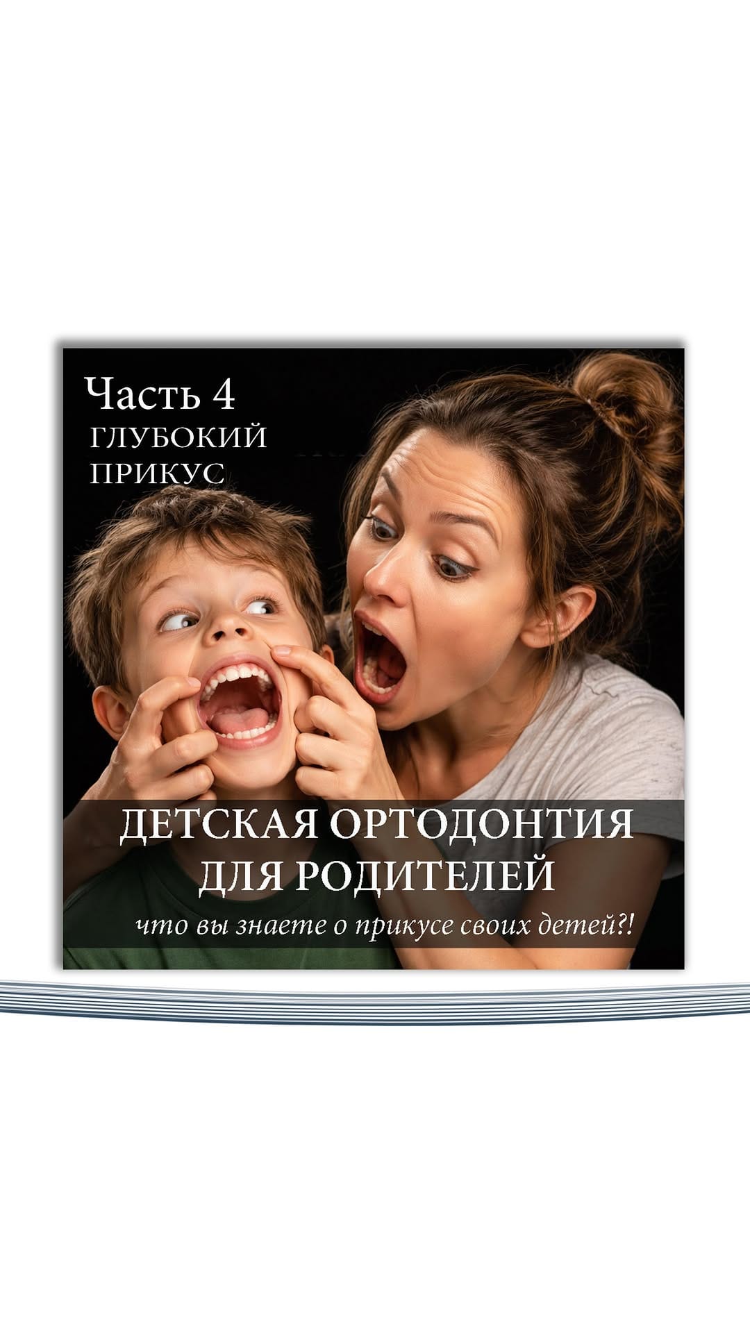 Post 7 by 𝙳𝚛. 𝙼𝚊𝚔𝚜𝚞𝚝 𝙱𝚎𝚑𝚛𝚞𝚣𝚘𝚐𝚕𝚞 Orthodontist / Ортодонт on Instagram (video)