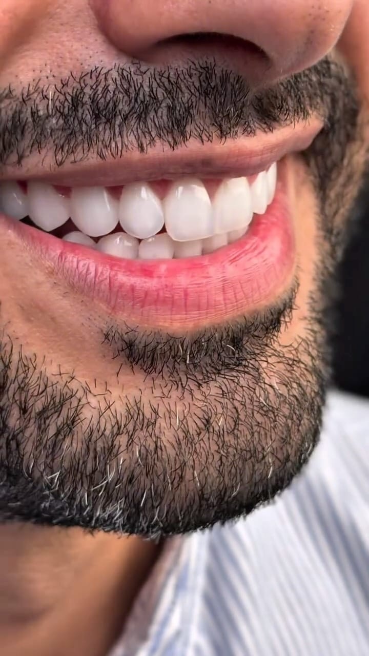Post 5 by Ammar zam on Instagram (video)