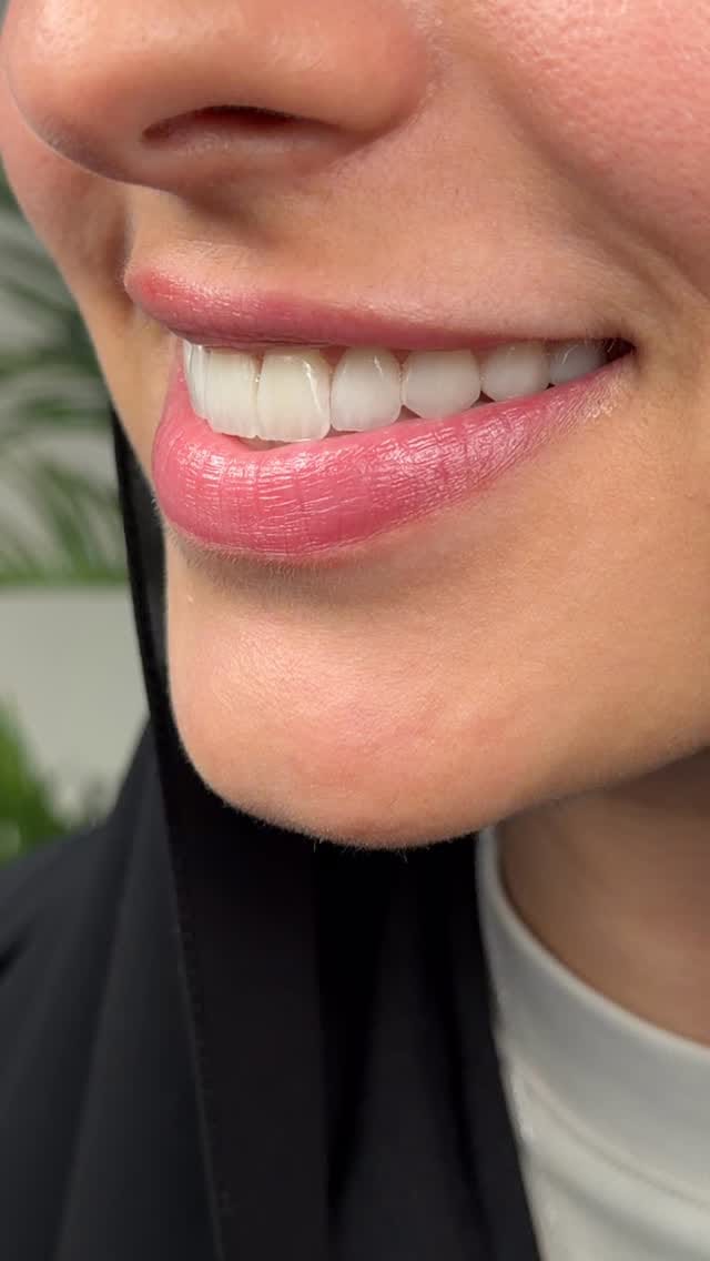 Post 3 by 𝗗𝗿. 𝗔𝗹𝗶 𝗝𝗮𝗺𝗮𝗹 𝗔𝗹𝗝𝗮𝘀𝗵𝗮𝗮𝗺𝘆 𝗗𝗗𝗦 on Instagram (video)