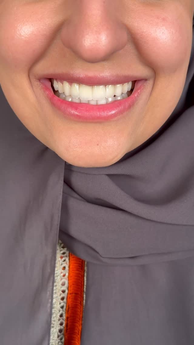 Post 7 by 𝗗𝗿. 𝗔𝗹𝗶 𝗝𝗮𝗺𝗮𝗹 𝗔𝗹𝗝𝗮𝘀𝗵𝗮𝗮𝗺𝘆 𝗗𝗗𝗦 on Instagram (video)