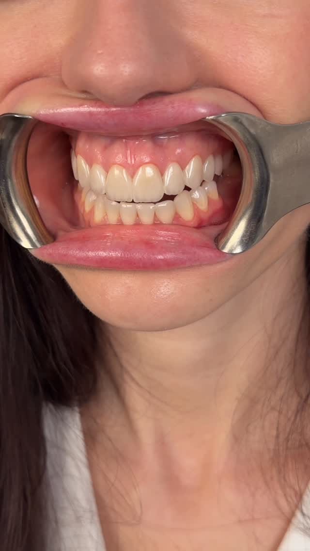 Post 1 by 𝗗𝗿. 𝗔𝗹𝗶 𝗝𝗮𝗺𝗮𝗹 𝗔𝗹𝗝𝗮𝘀𝗵𝗮𝗮𝗺𝘆 𝗗𝗗𝗦 on Instagram (video)