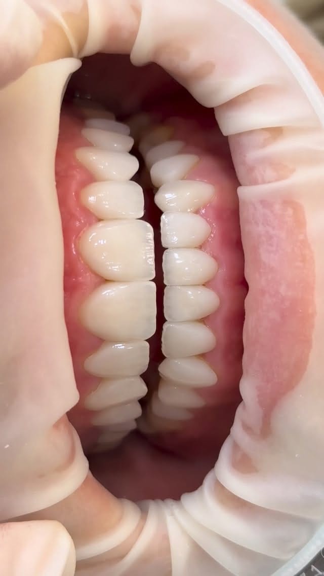 Post 3 by Dr.Cansu Gursoy on Instagram (video)
