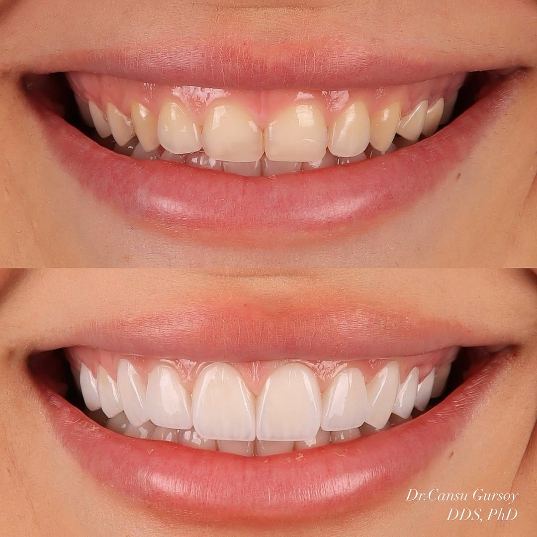 Post 8 by Dr.Cansu Gursoy on Instagram (image)