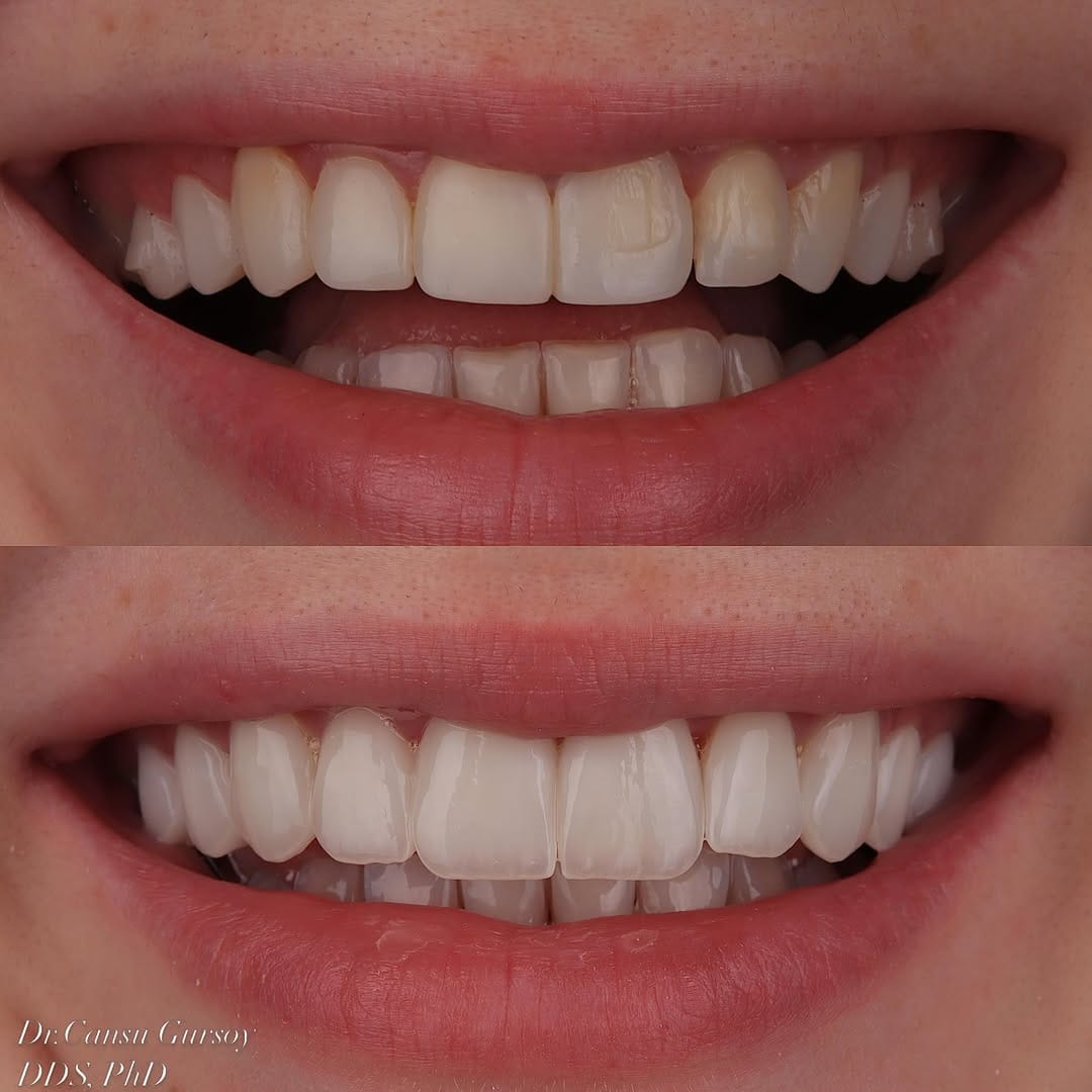 Post 7 by Dr.Cansu Gursoy on Instagram (image)