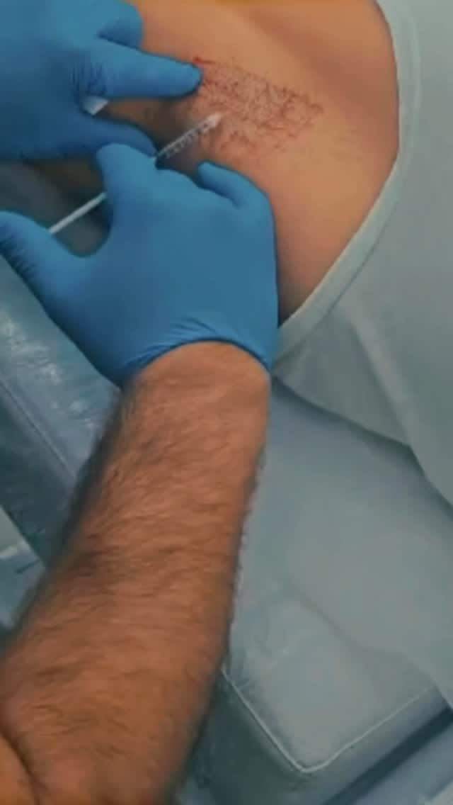 Post 6 by Essam Al Bitar on Instagram (video)