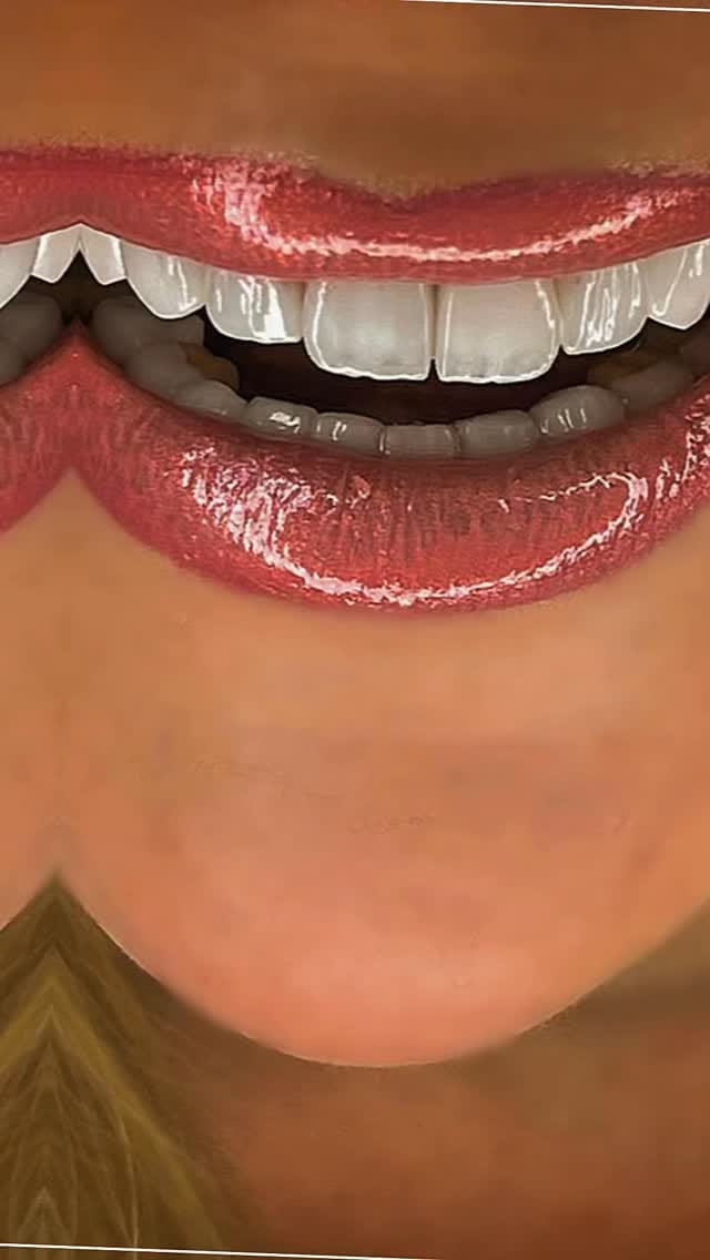 Post 9 by Essam Al Bitar on Instagram (video)