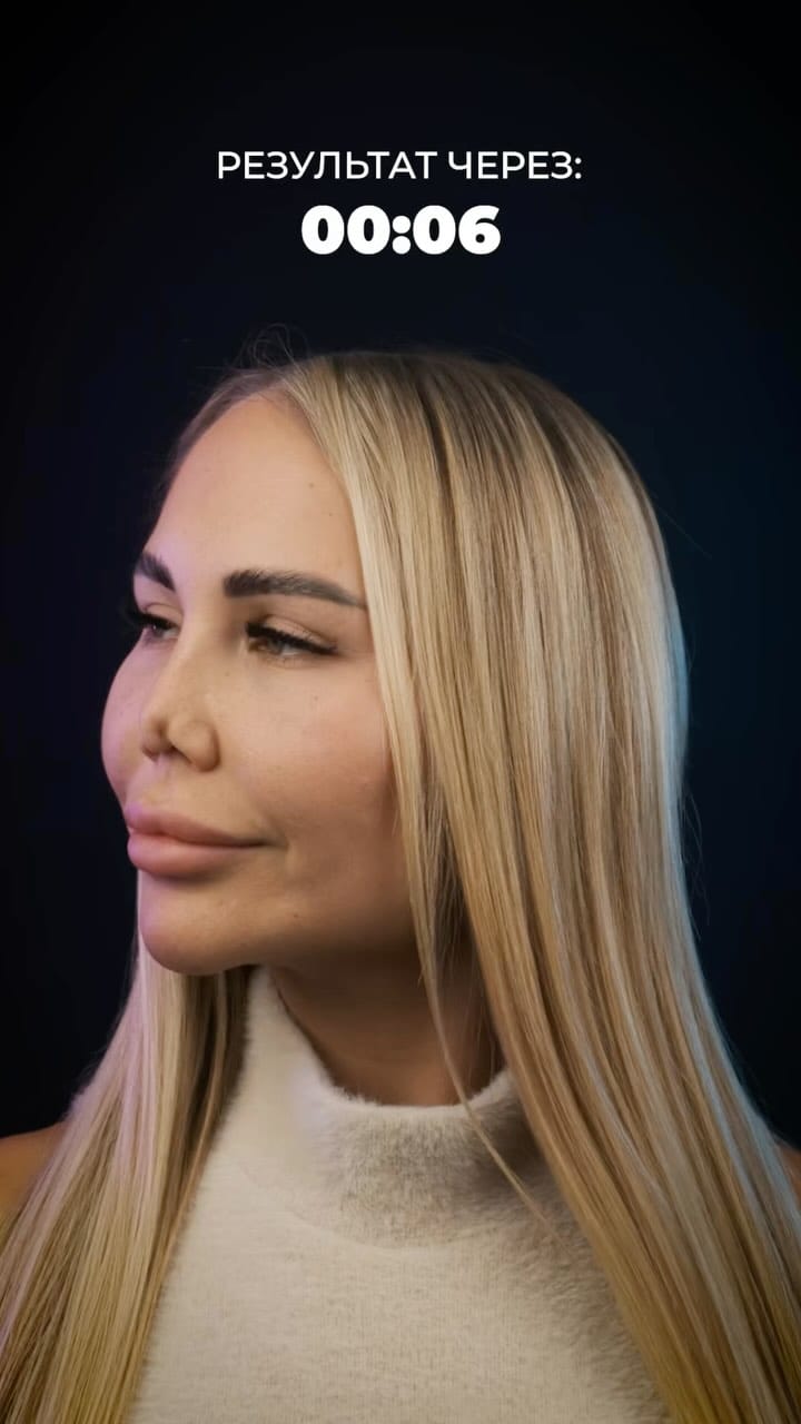Post 10 by RHINOPLASTY ALMATY | DUBAI on Instagram (video)
