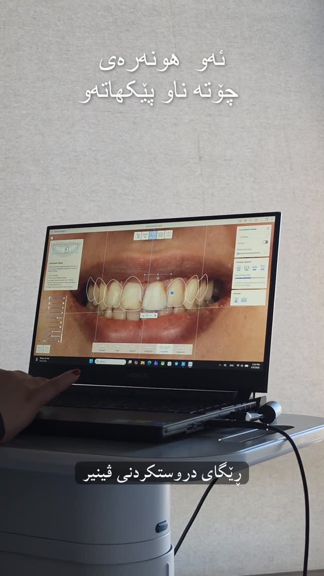 Post 3 by Dr. Nabaa Hayali  نبأ الحيالي on Instagram (video)