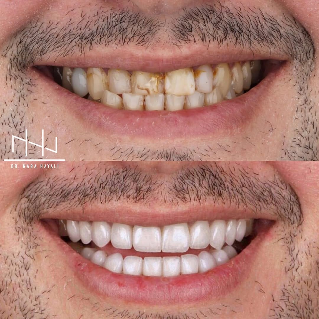 Post 10 by Dr. Nabaa Hayali  نبأ الحيالي on Instagram (image)
