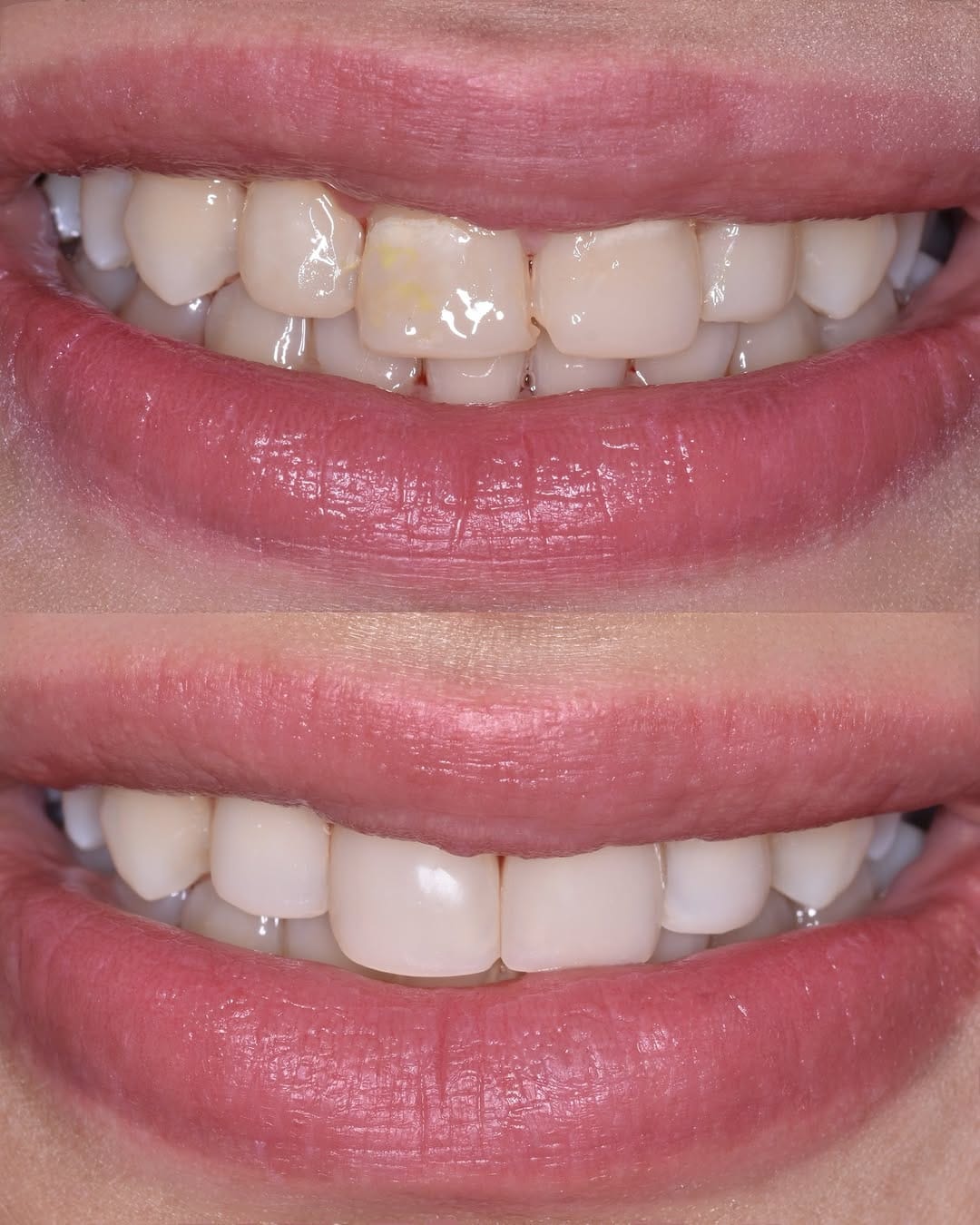 Post 10 by Dr.Ban Al Mishhadani | Dentist - طبيبة أسنان 🦷 on Instagram (carousel)