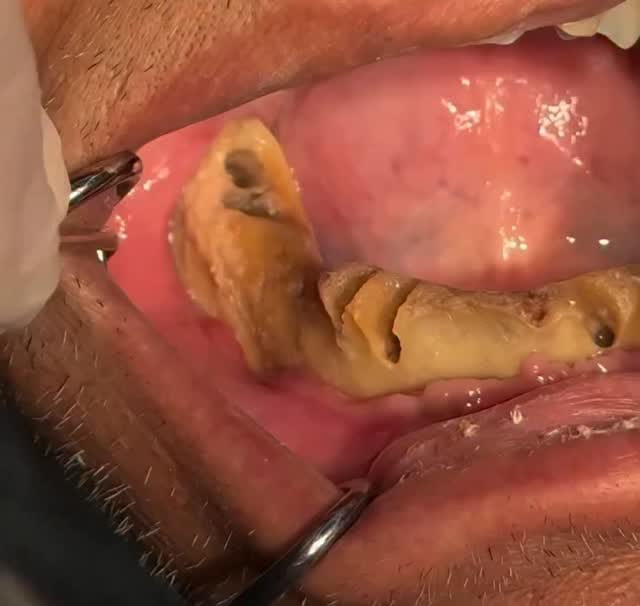 Post 1 by Arte y Ciencia Odontológica on Instagram (video)