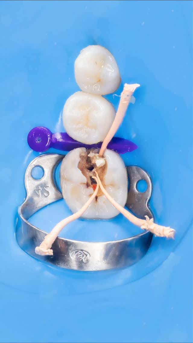 Post 5 by Arte y Ciencia Odontológica on Instagram (video)