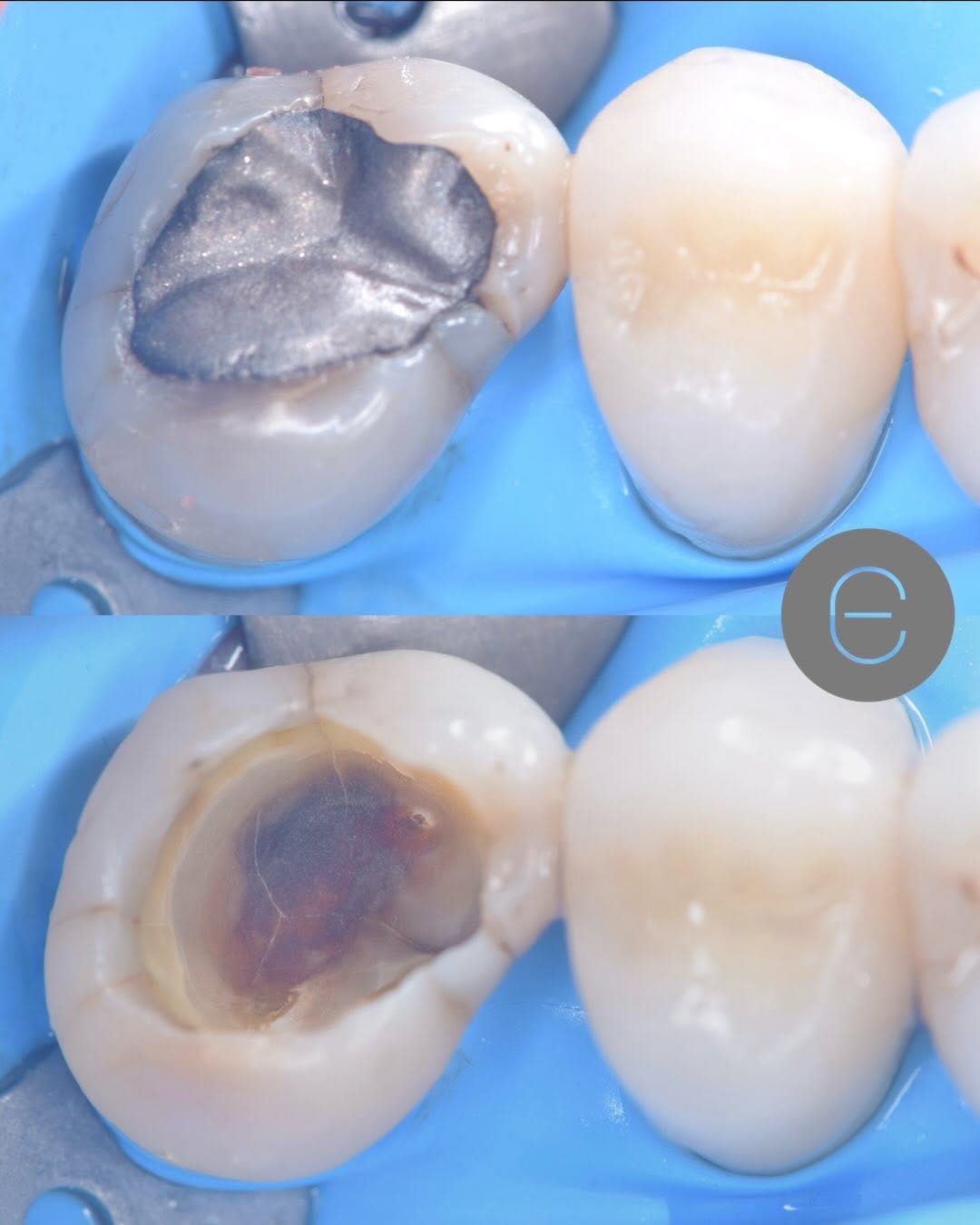 Post 3 by Arte y Ciencia Odontológica on Instagram (carousel)