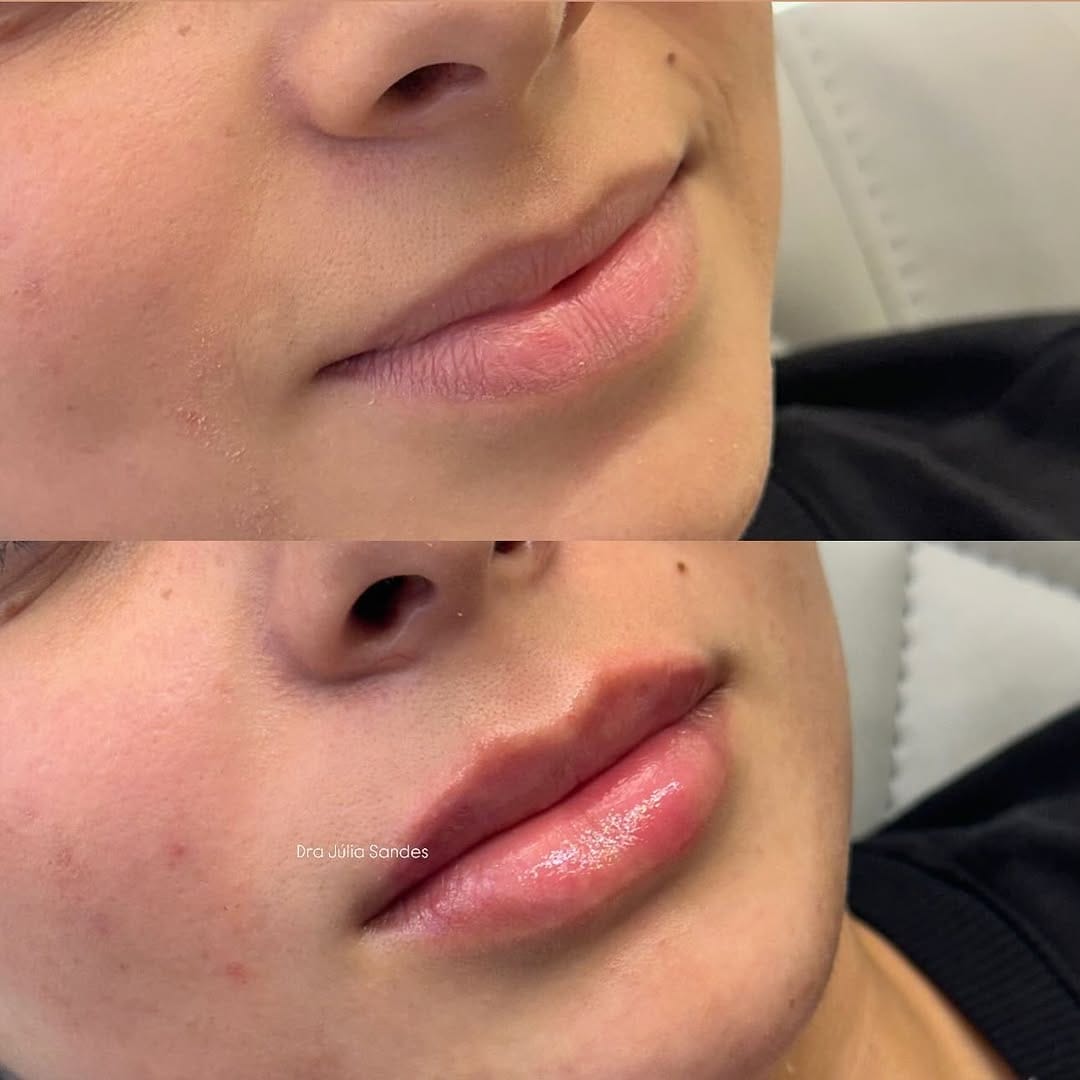 Post 10 by Dra. Júlia Sandes | Harmonização Facial on Instagram (image)