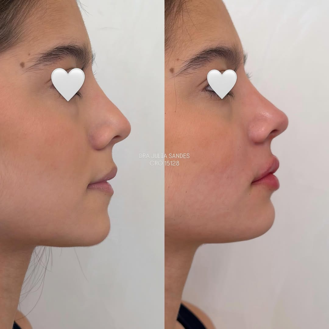 Post 4 by Dra. Júlia Sandes | Harmonização Facial on Instagram (image)