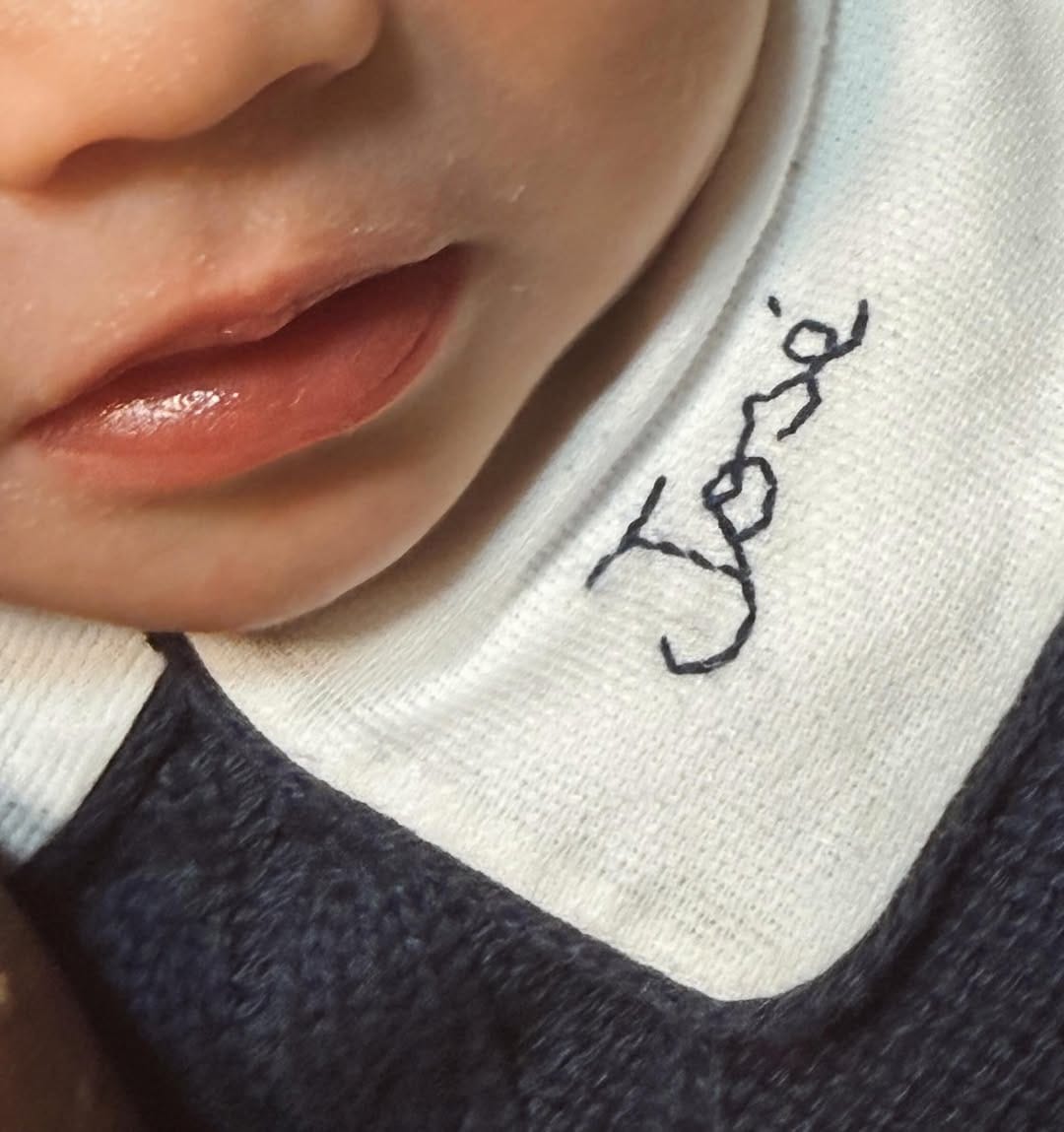 Post 2 by Dra. Júlia Sandes | Harmonização Facial on Instagram (carousel)
