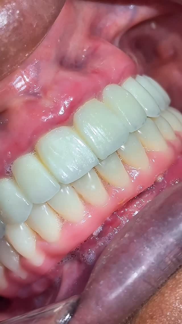 Post 2 by Leonardo campos  🇧🇷 🎨🦷 on Instagram (video)