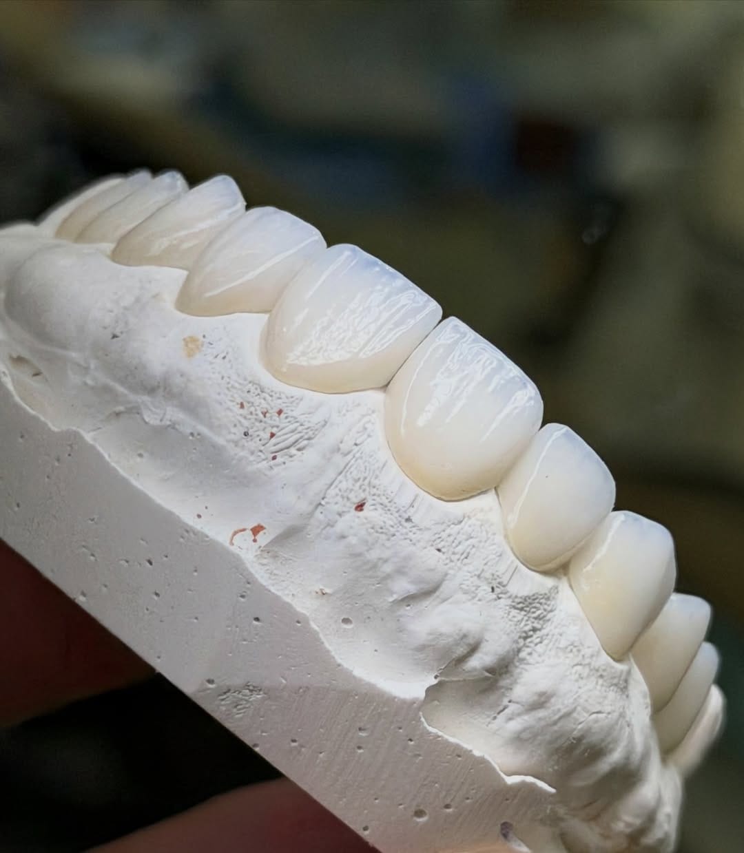 Post 4 by Leonardo campos  🇧🇷 🎨🦷 on Instagram (image)