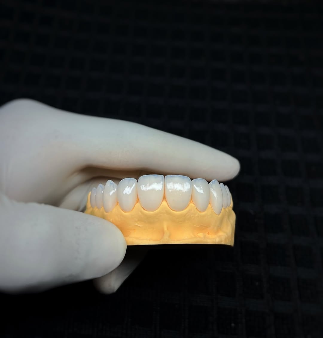 Post 2 by Dr. Glauberton Ricardo •Mimetizar Sorriso e Face on Instagram (image)