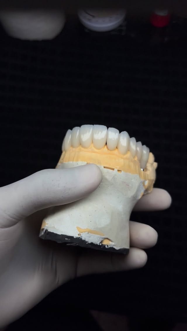 Post 3 by Dr. Glauberton Ricardo •Mimetizar Sorriso e Face on Instagram (video)