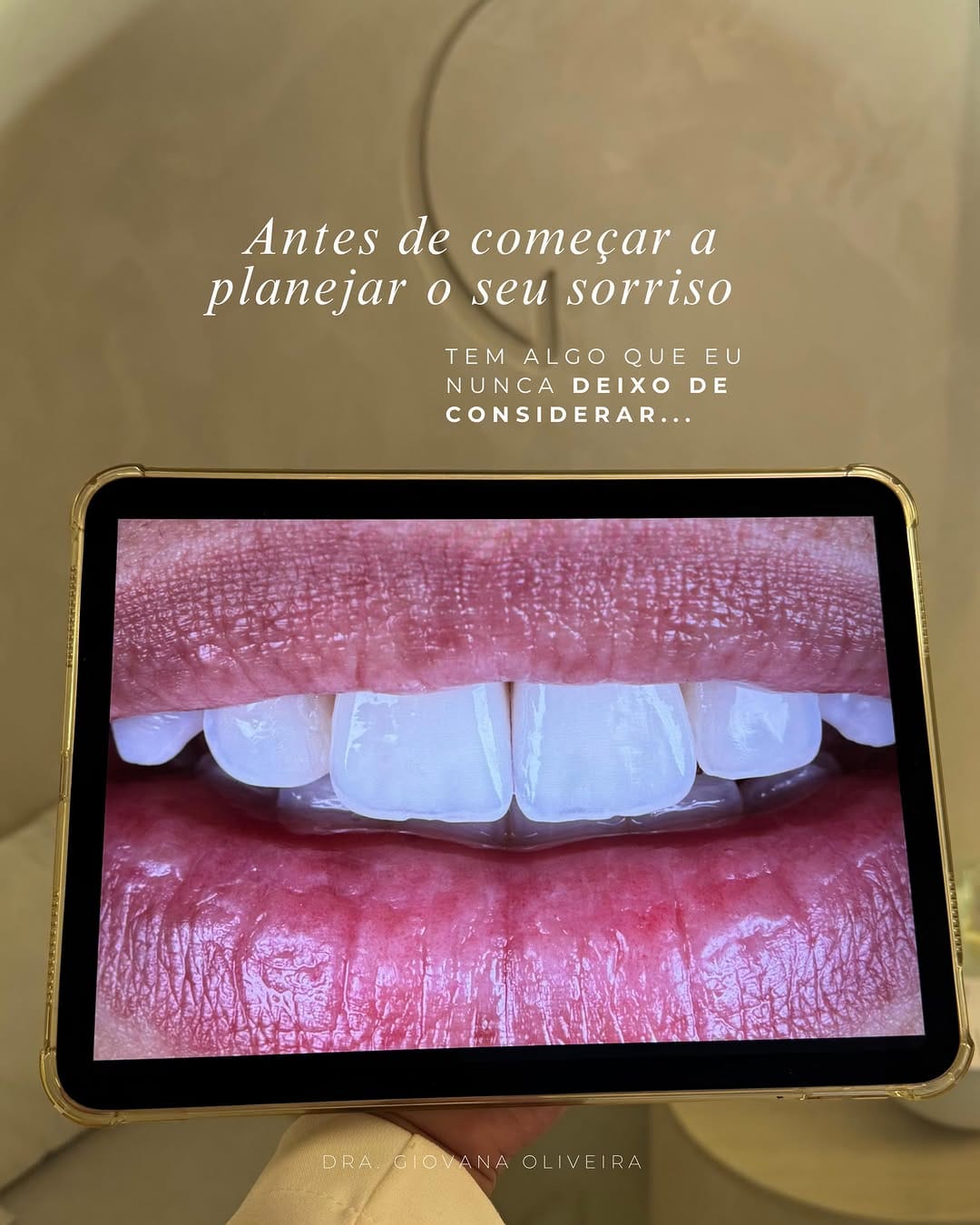 Post 7 by Giovana Oliveira | Lentes Naturais on Instagram (carousel)