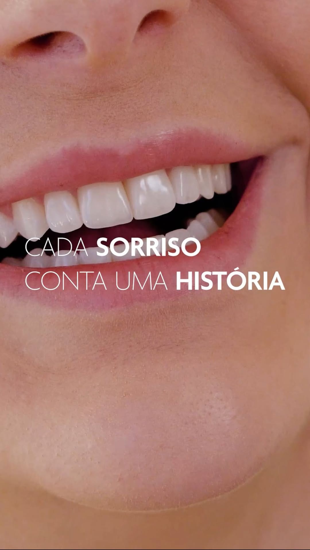 Post 9 by Giovana Oliveira | Lentes Naturais on Instagram (video)