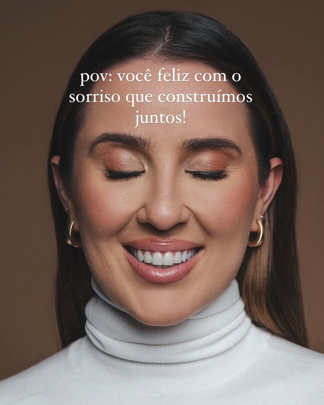 Post 10 by Giovana Oliveira | Lentes Naturais on Instagram (carousel)