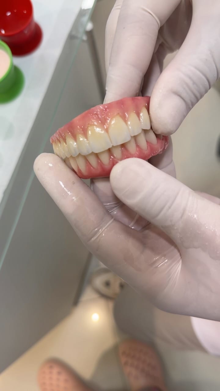 Post 3 by Dr.Edmo Matheus - Odontologia Estética e Implantes 🇧🇷 on Instagram (video)