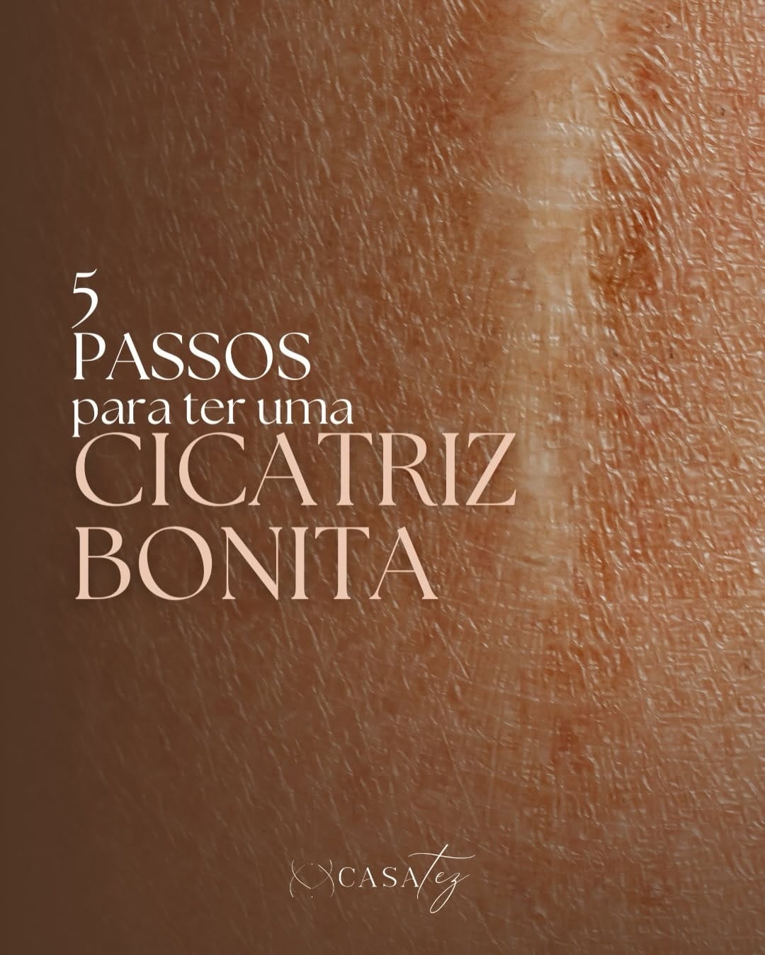 Post 2 by Casa Tez on Instagram (carousel)