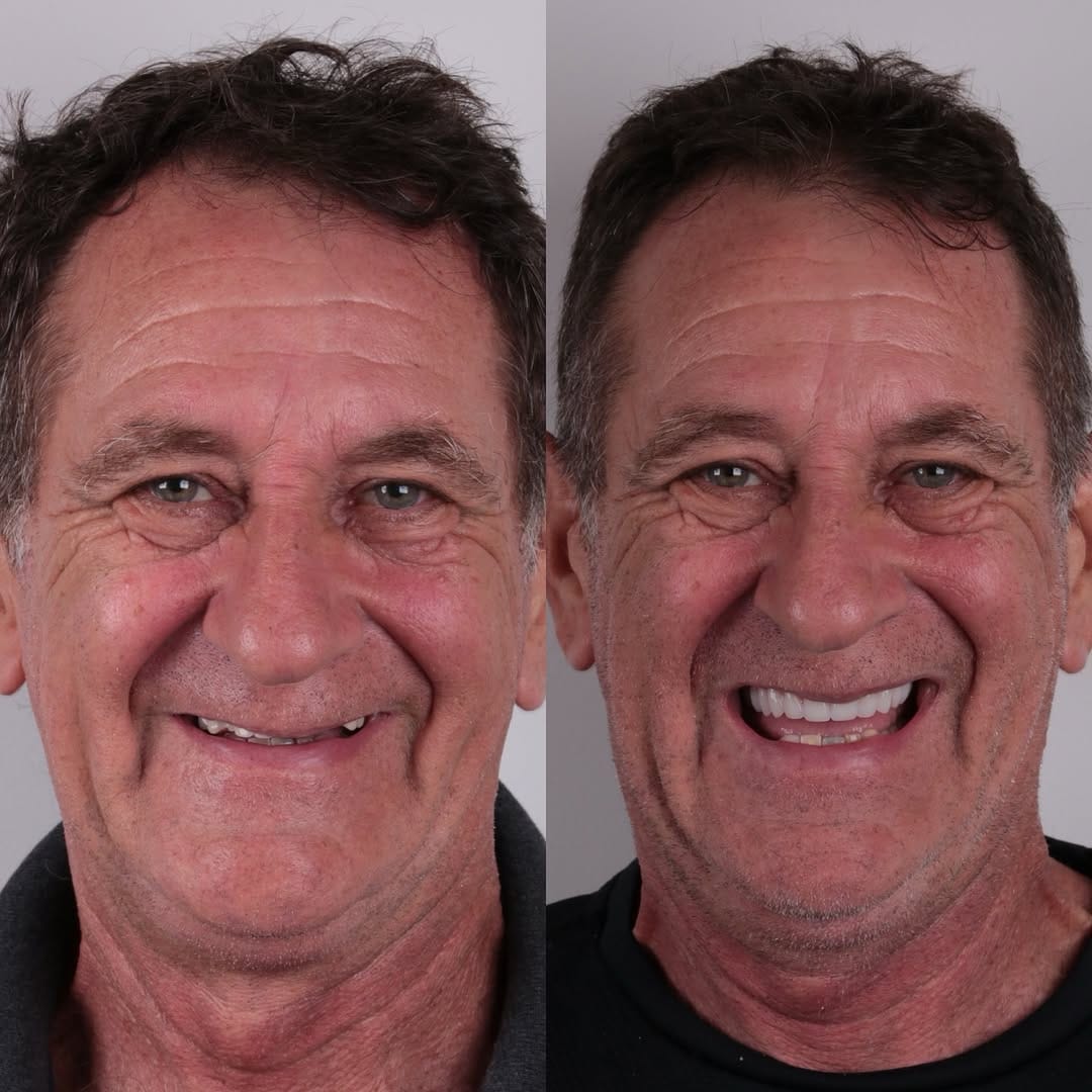 Post 9 by Dr Artur César • dentista on Instagram (carousel)