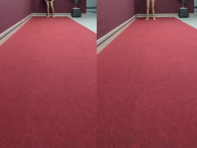 Post 7 by Op.  Dr.  Emre ŞAHBAZ on Instagram (video)