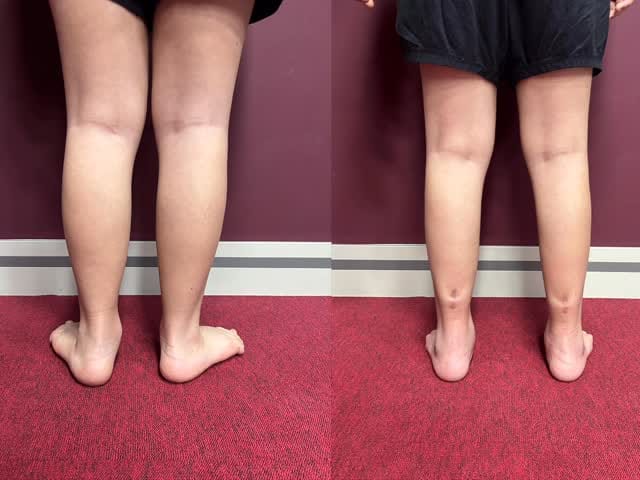 Post 3 by Op.  Dr.  Emre ŞAHBAZ on Instagram (video)