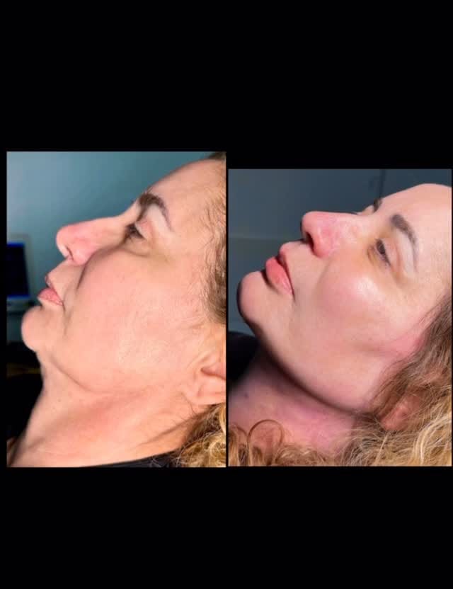 Post 7 by OdontoFace Curitiba on Instagram (video)