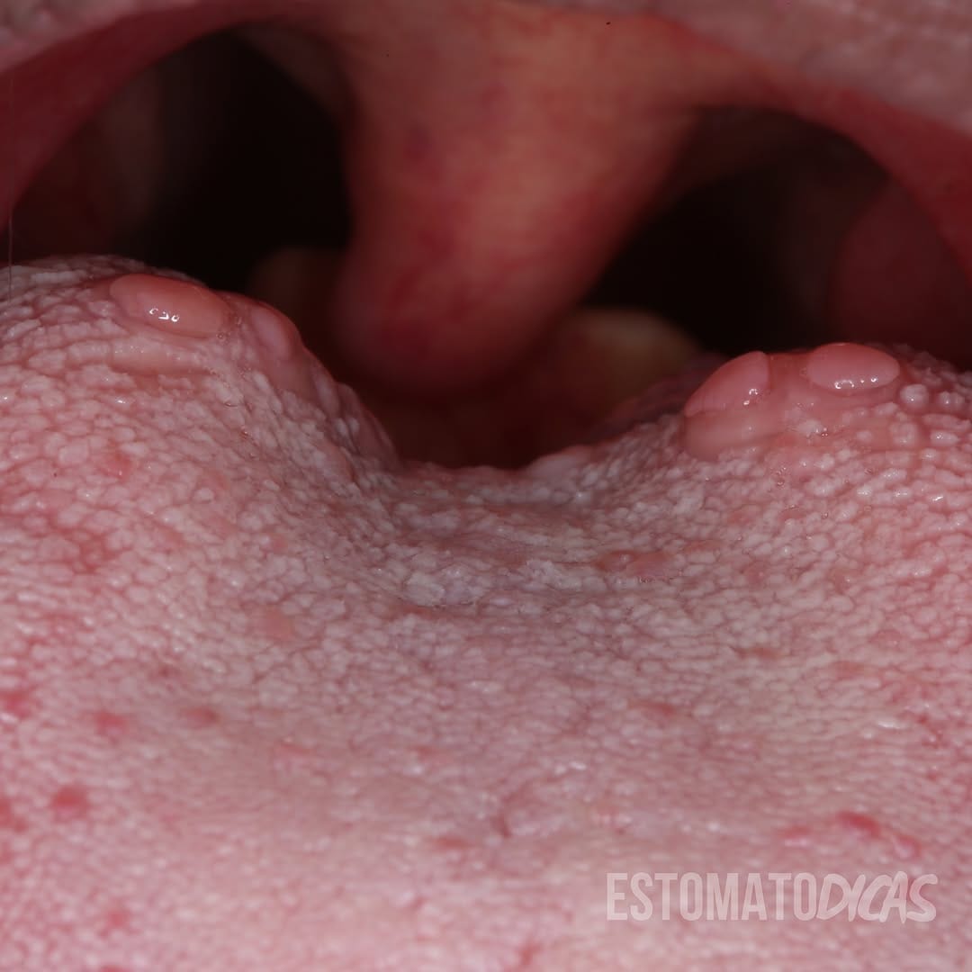 Post 8 by Yuri Medeiros | Estomatologia on Instagram (carousel)