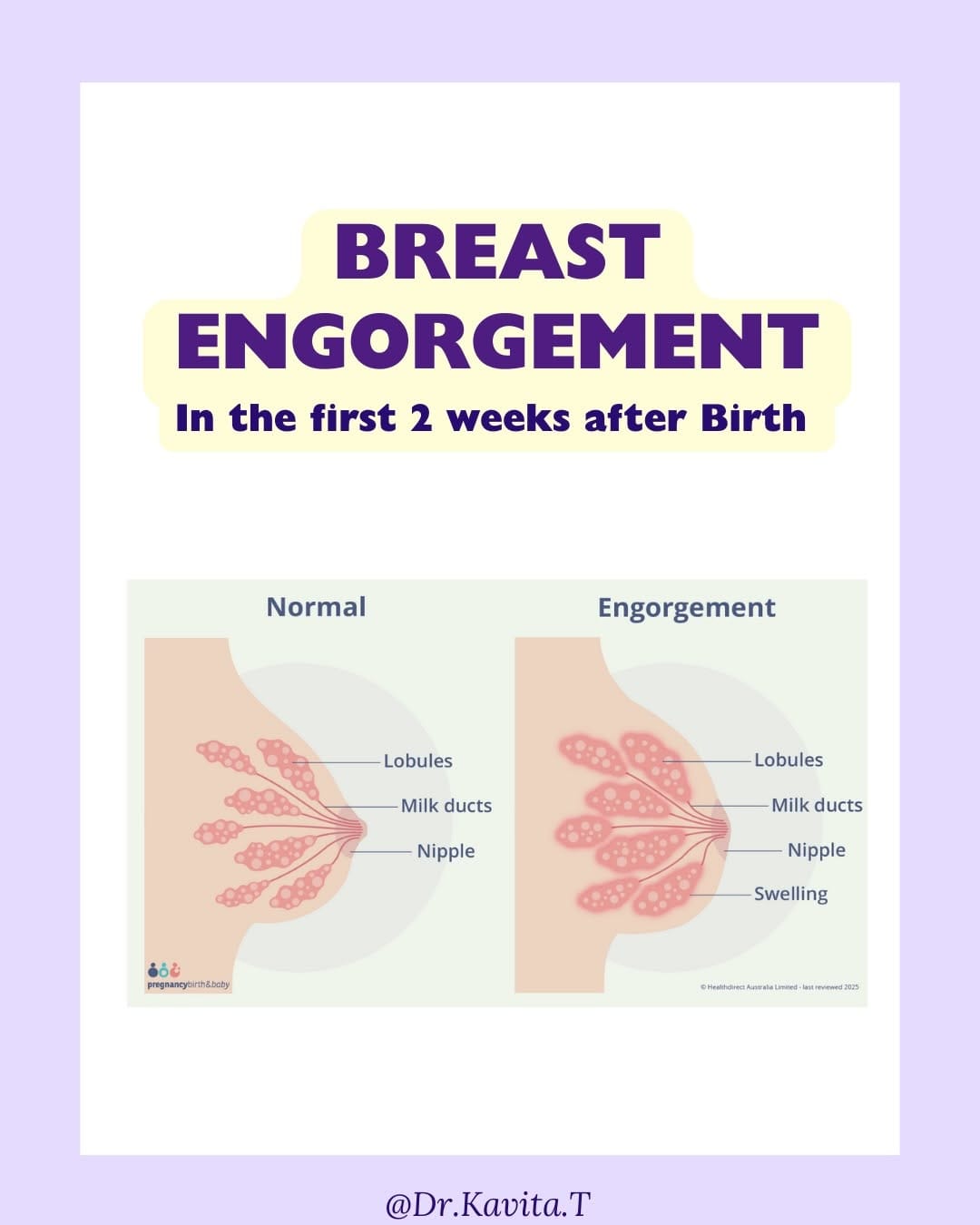 Post 6 by Dr Kavita - Breastfeeding Medicine on Instagram (carousel)
