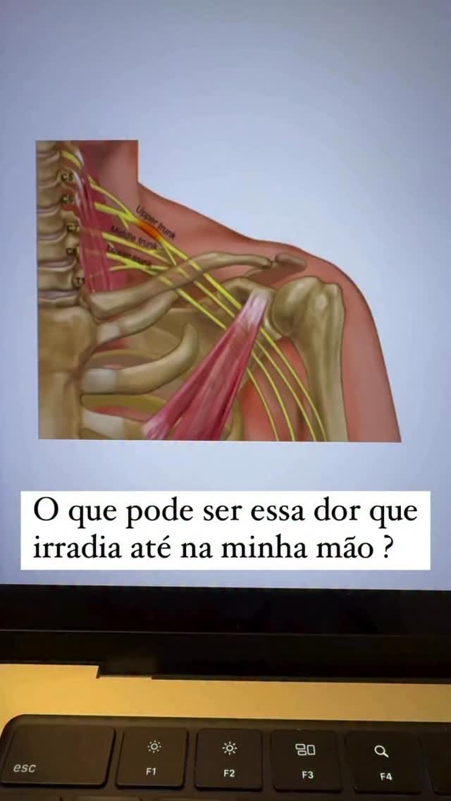 Post 6 by Dr. Vinício Nunes - Goiânia / Hérnia de Disco / Escoliose on Instagram (video)