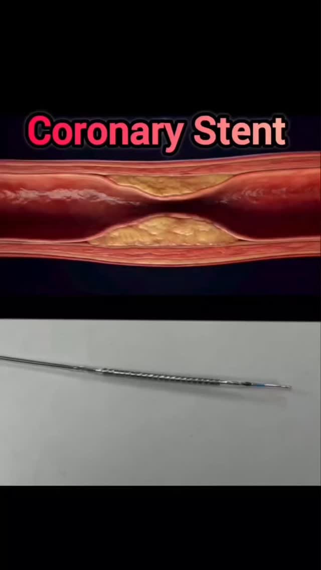 Post 5 by Bruno Rebelo on Instagram (video)