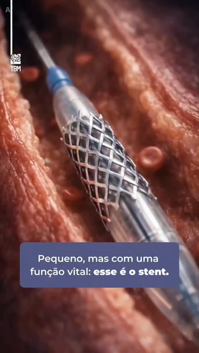 Post 3 by Bruno Rebelo on Instagram (video)