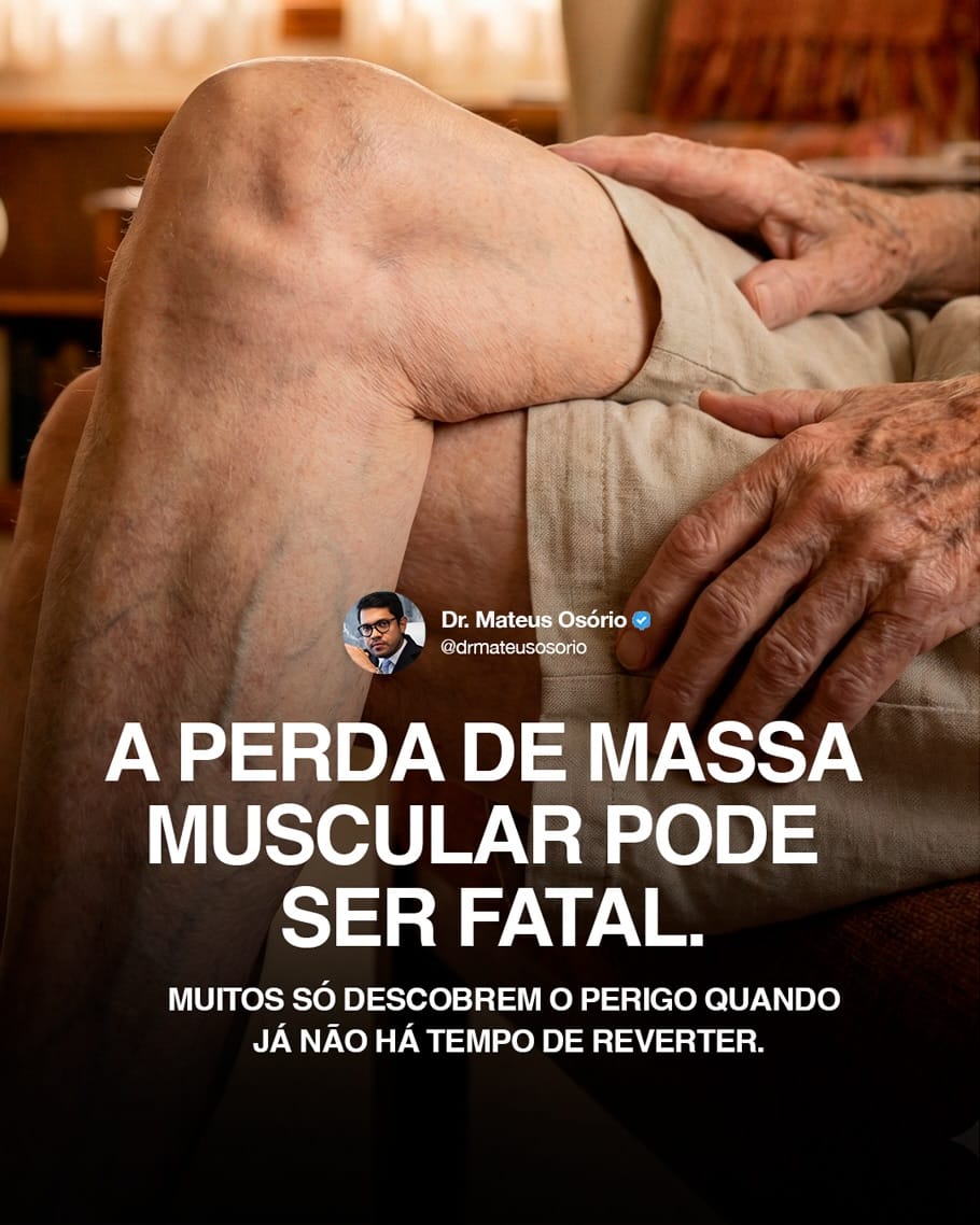 Post 9 by Mateus Osório CRMSP 215405 on Instagram (carousel)