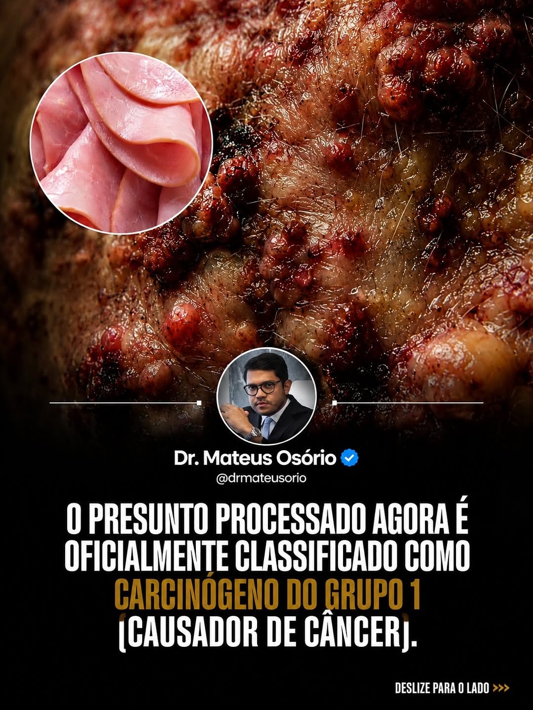 Post 3 by Mateus Osório CRMSP 215405 on Instagram (carousel)